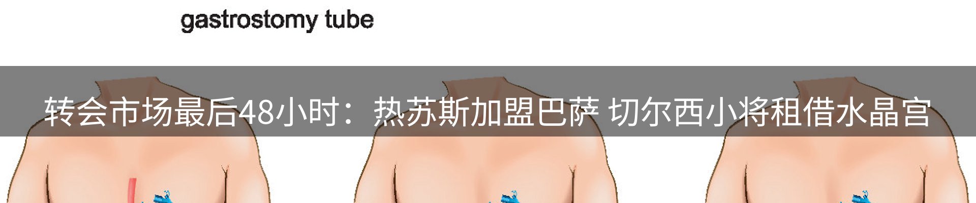 平台精选